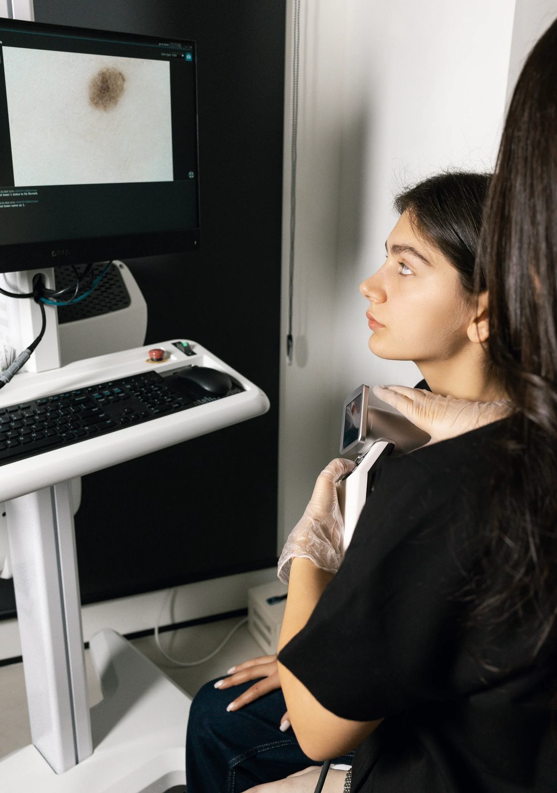 Reviewing the dermoscopic images together on screen