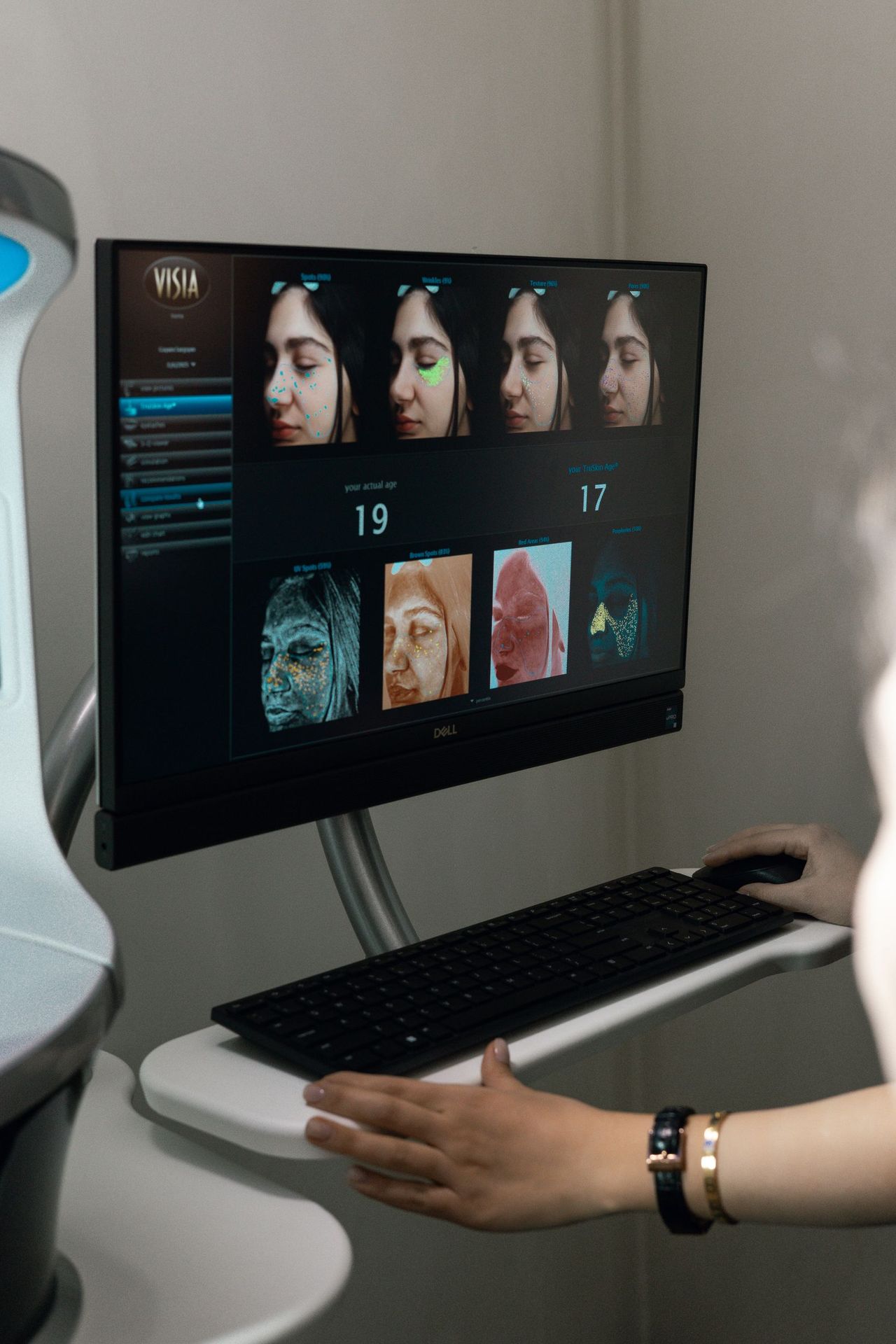 The VISIA report screen showing the eight analysed skin features and TruSkin Age
