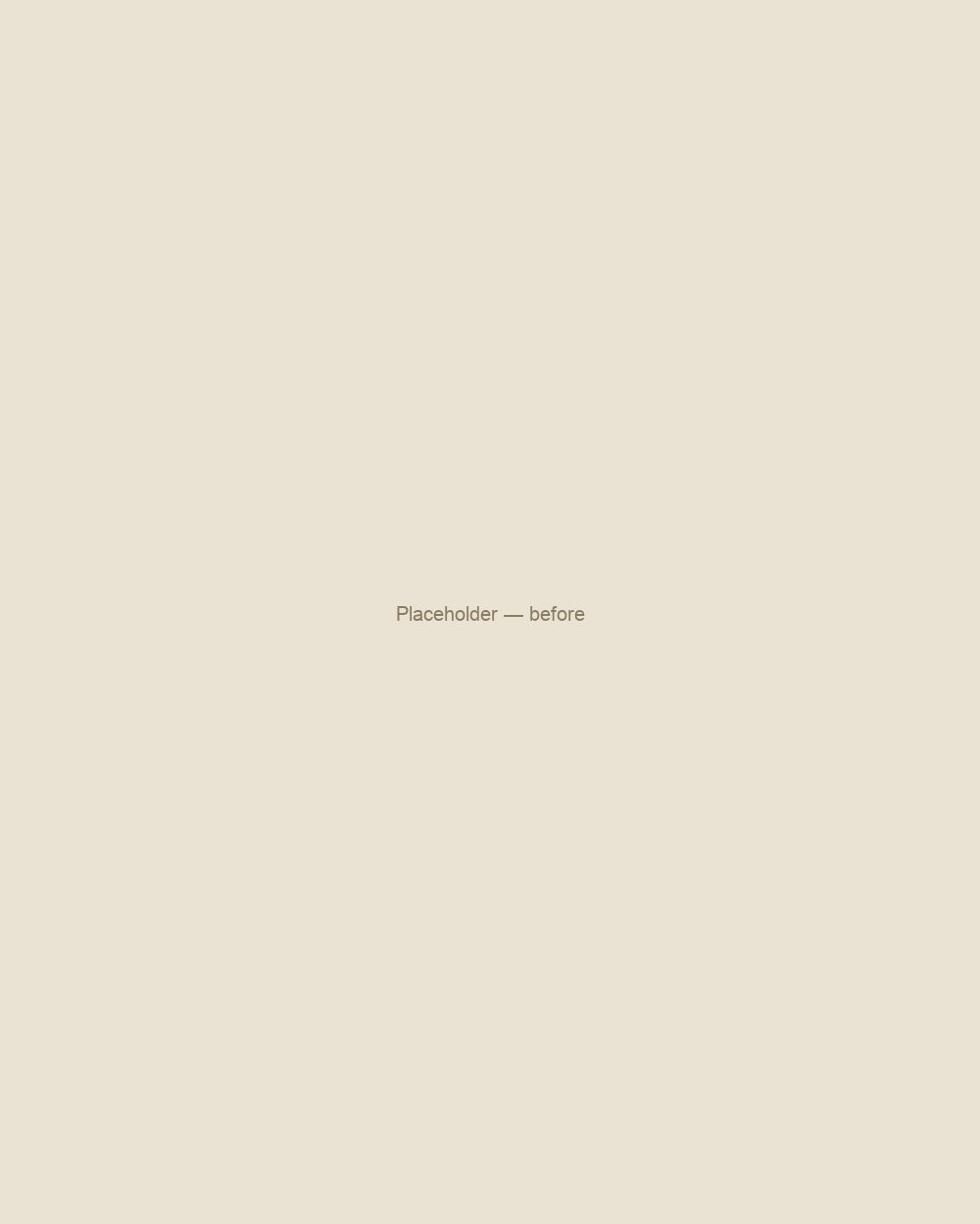 Sensitive Skin — before