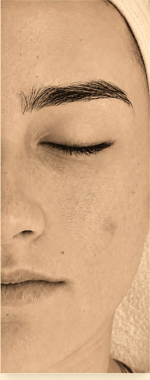 Dehydrated skin before