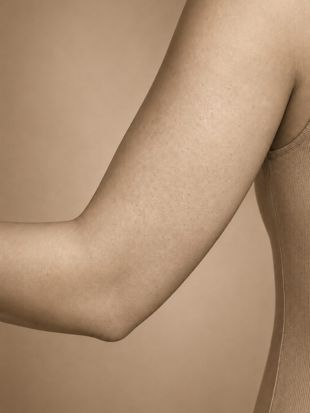 Uneven body texture — after