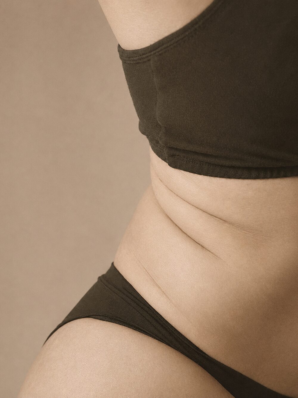 Localized fat — after