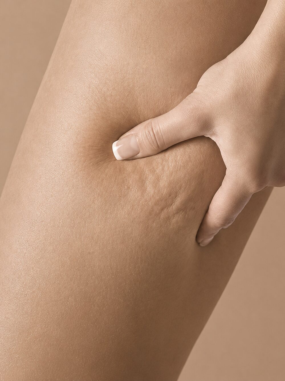 Cellulite — before