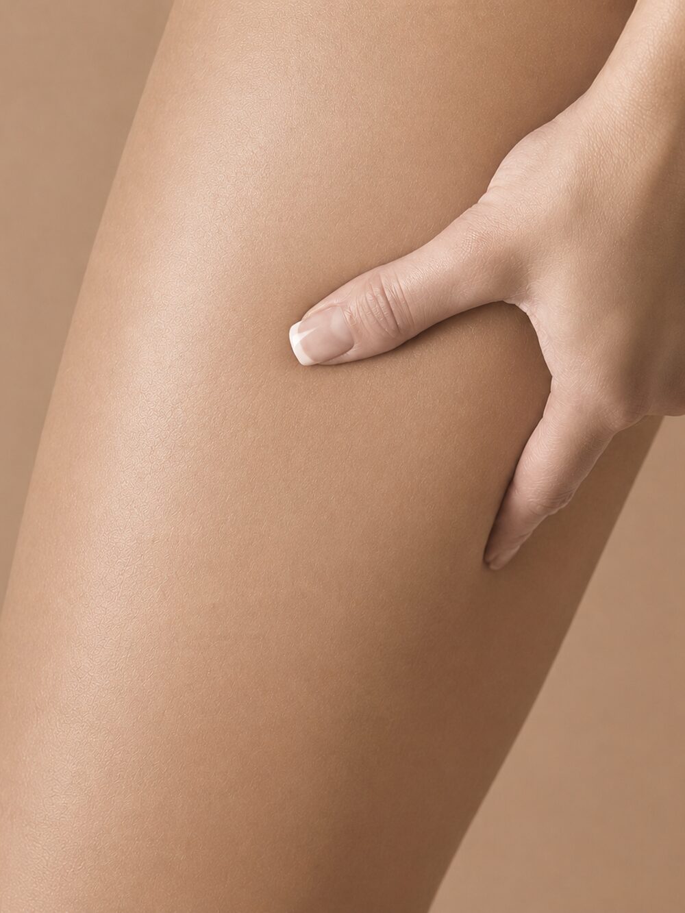 Cellulite — after