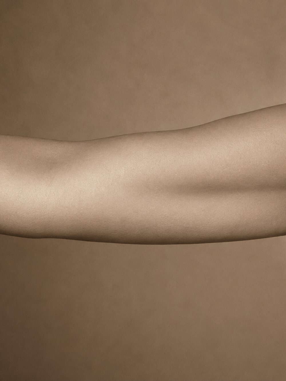 Body skin laxity — after