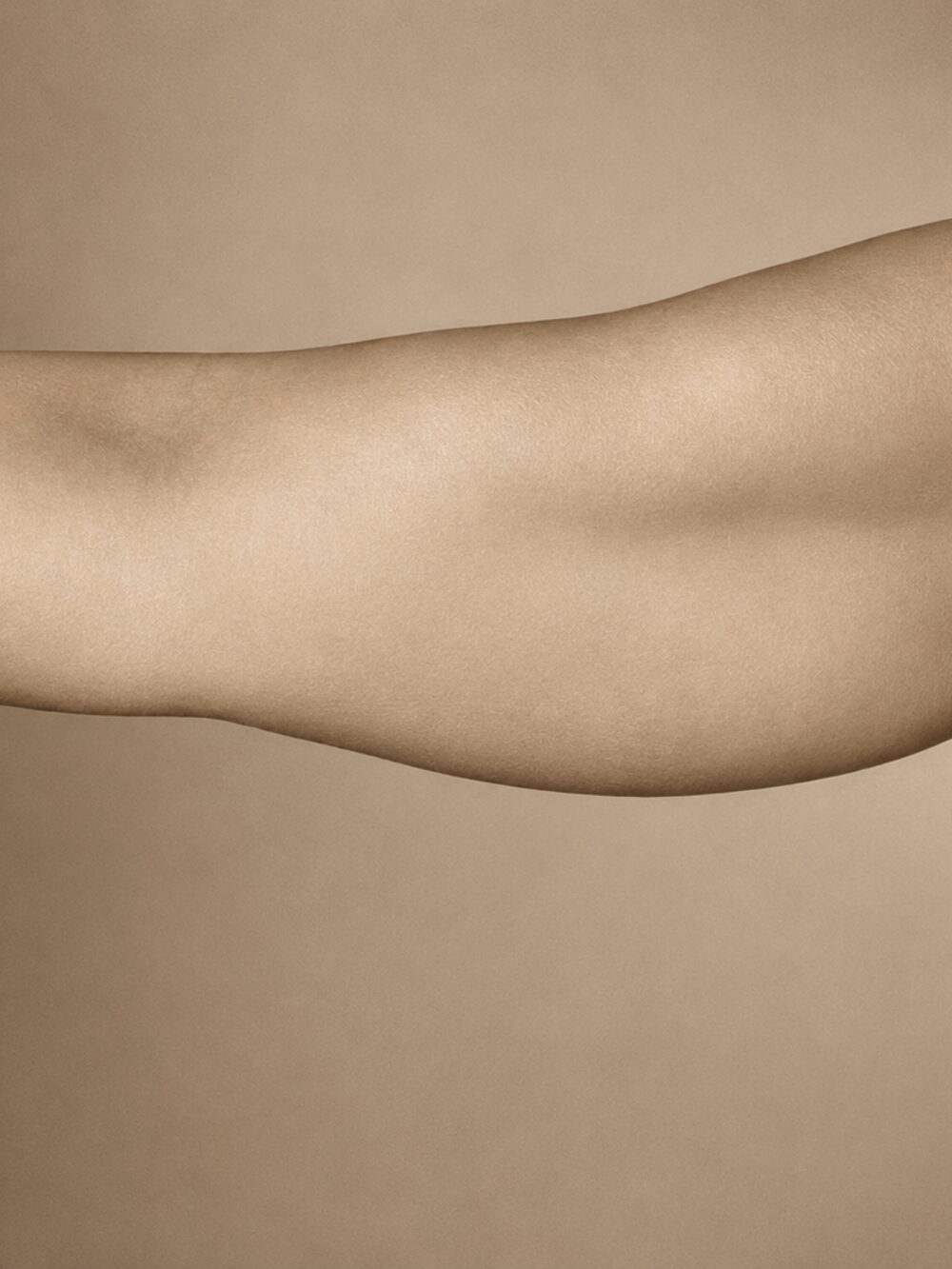 Body skin laxity — before