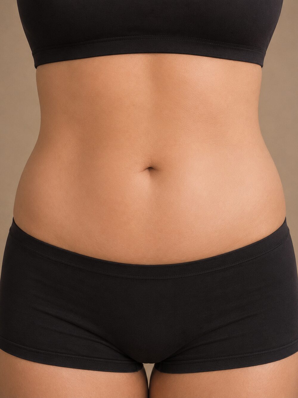 Body contouring — before